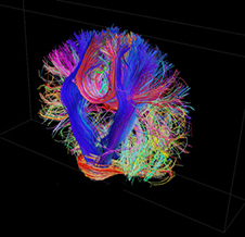 brains scan image
